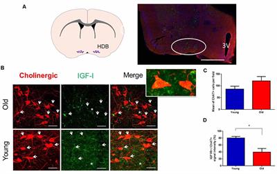 Reduced Insulin-Like Growth Factor-I Effects in the Basal Forebrain of Aging Mouse